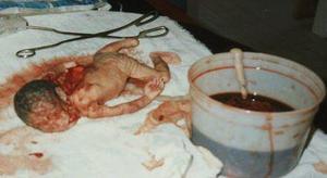 abortion is murder.jpg